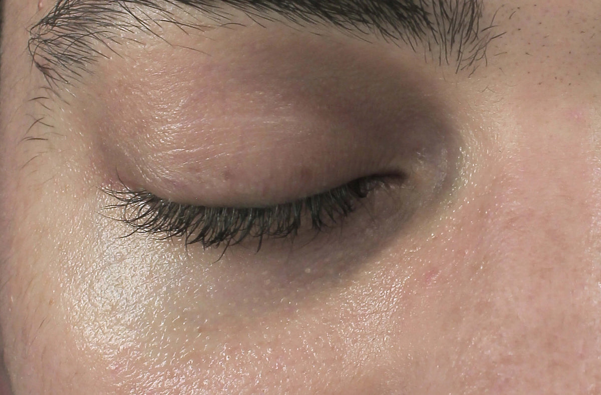 After